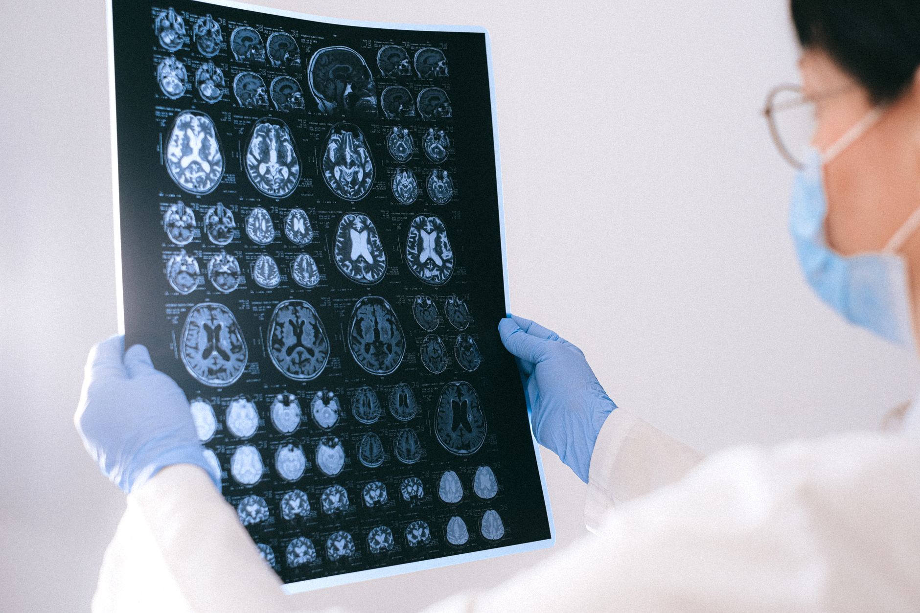 Alzheimer’s Disease Treatment: Proven New Hope for Patients